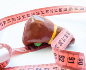 Natural Health And Well-Being - Natural Synergy Blog 33 fatty liver